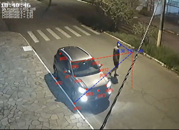 Análise postural 1