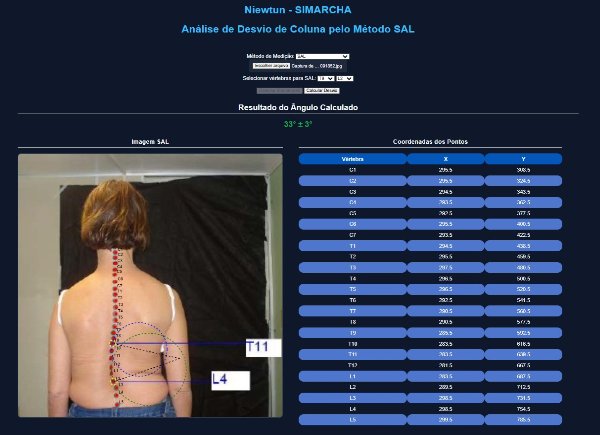Análise postural 1